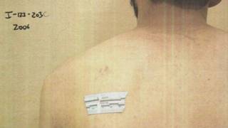 160206130106_aclu_624x351_aclu_nocredit.