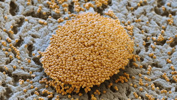 Myxococcus xanthus (Foto: Eye of Science/SPL)