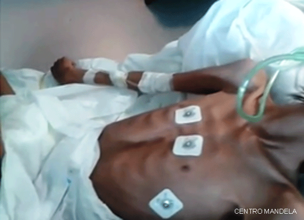 Oscar Sánchez (foto: Centro Mandela) 150910224135_desnutricion_centromandela_