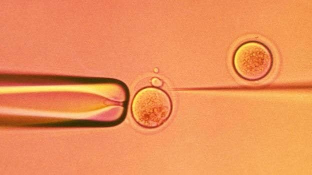 151021150258_baby_fertilisation.jpg
