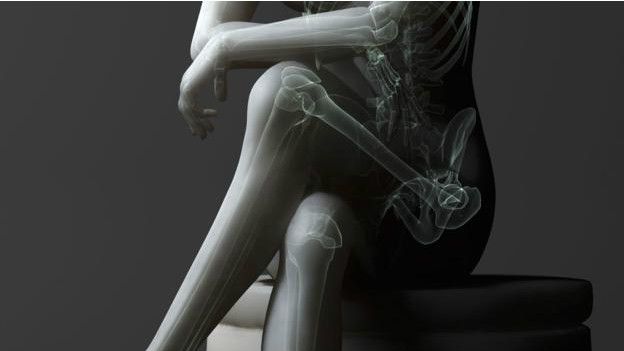 Una radiografía de una persona con las piernas cruzadas