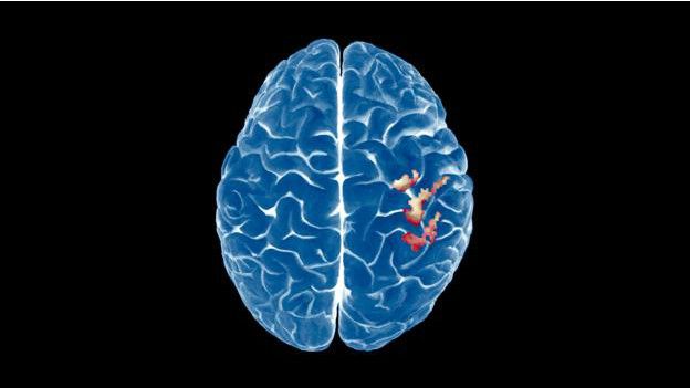 Un cerebro