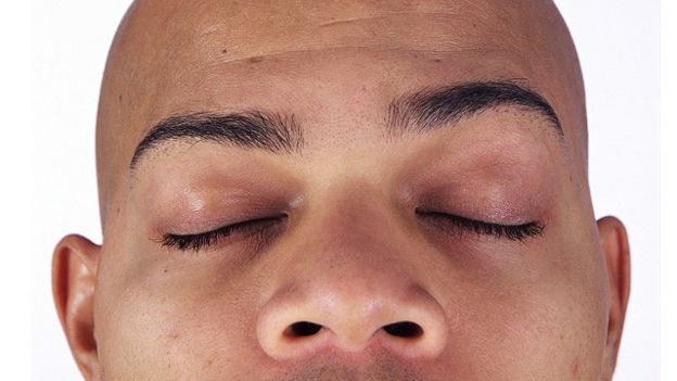 151118141544_nose_640x360_thinkstock_noc