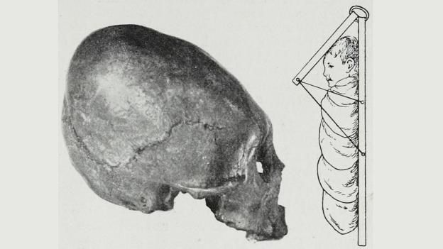 151126120635_skull_reshaping_4.jpg