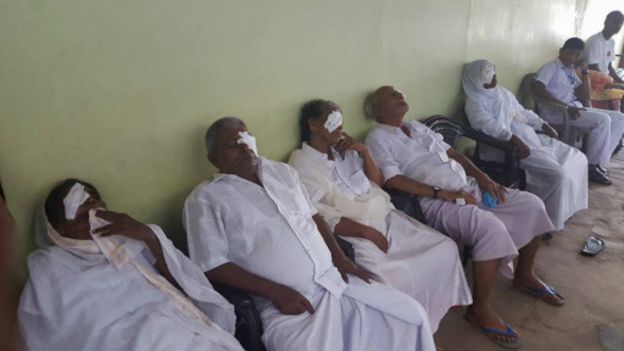 151128184150_lanka_cataract_patients_512