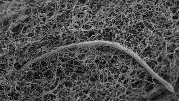 Un nematodo