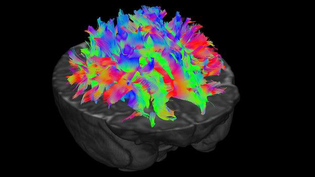Разные цвета обозначают нервные волокна, идущие в разных направлениях – таким образом ученые выясняют, какие именно проводящие пути связывают различные отделы мозга