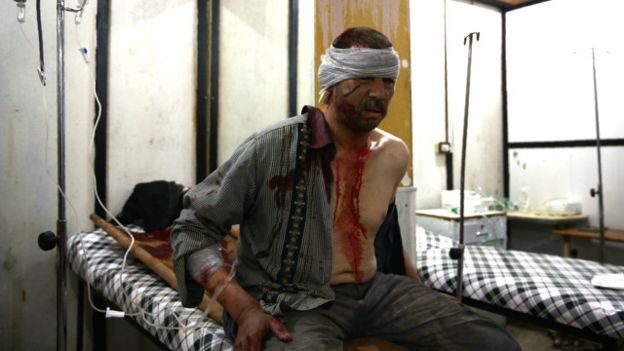 Heridos por la guerra en Siria