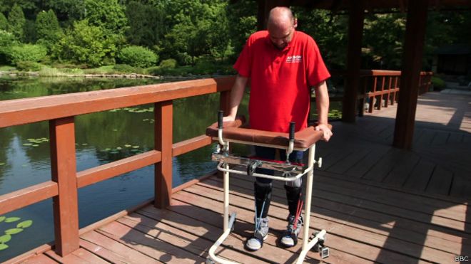 141022105904_darek_fidyka_640x360_bbc.jp