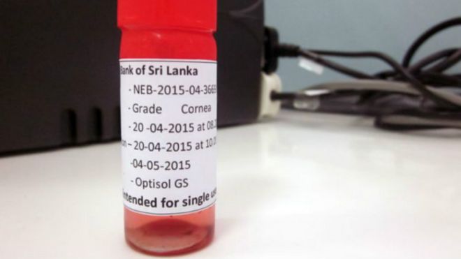 இலங்கையில் இருந்து மற்ற பல நாடுகளுக்கு கருவிழிப்படலம் அனுப்பி வைக்கப்படுகிறது