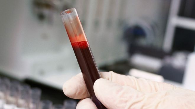 Análisis de sangre