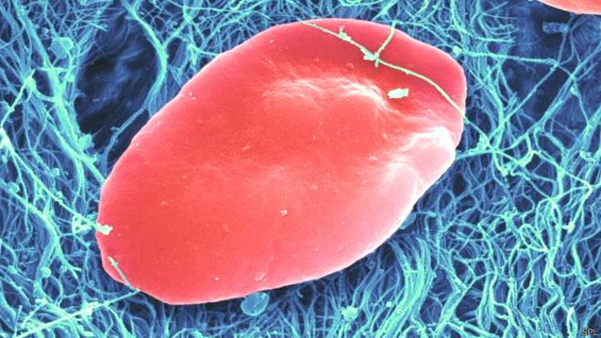 http://ichef-1.bbci.co.uk/news/ws/660/amz/worldservice/live/assets/images/2016/04/08/160408173140_platelets_the_part_of_the_blood_624x351_spl.jpg