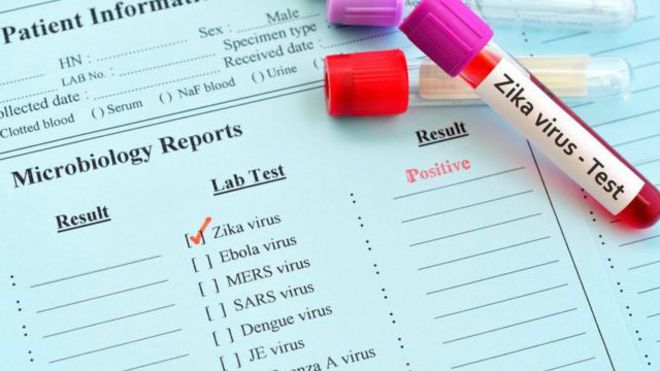 فيروس زيكا يبقى في السائل المنوي فترة أطول من الشائع