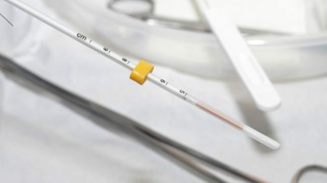 اللولب "أفضل من حبوب منع الحمل"