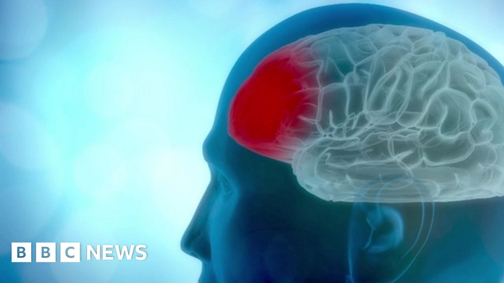 Dirty Air Damaged Brains Cambridge Study On Dementia Risk - tg5suy7