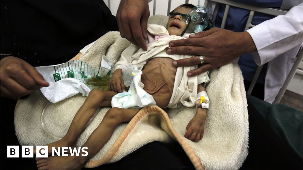 yemen-food-crisis-could-become-famine-this-year-un-warns-bbc-news