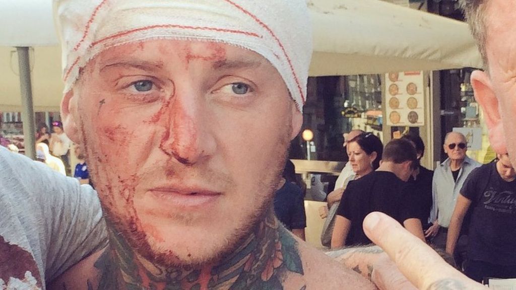 Leicester fans injured in fresh Madrid clashes with police