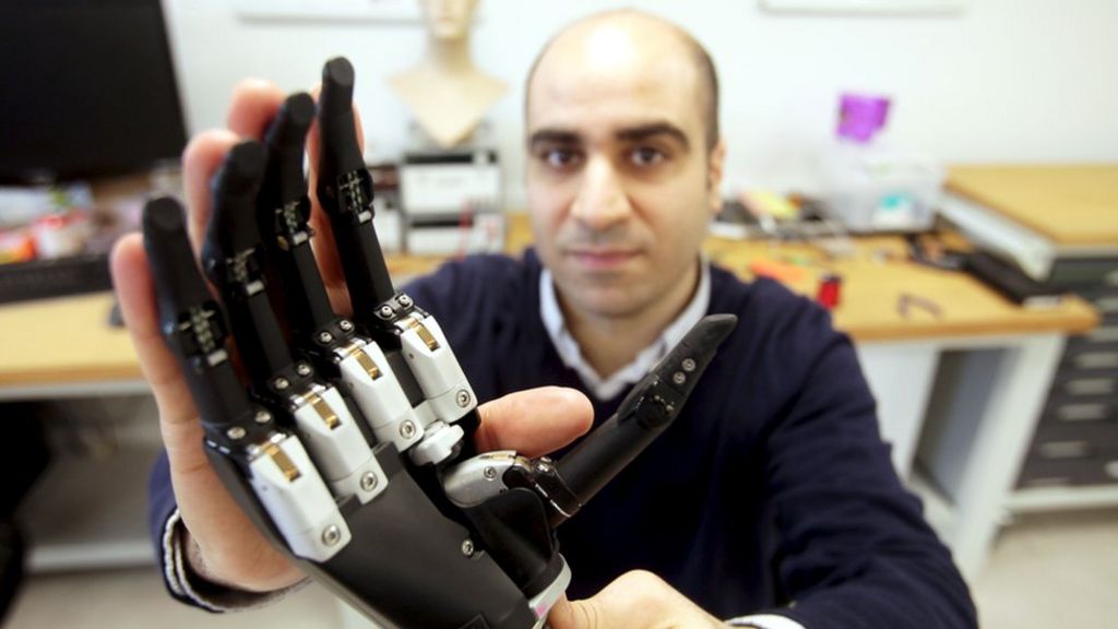Bionic hand 'sees and grabs' objects automatically