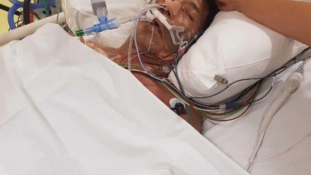 Man loses legs to flesh-eating bug in Australia