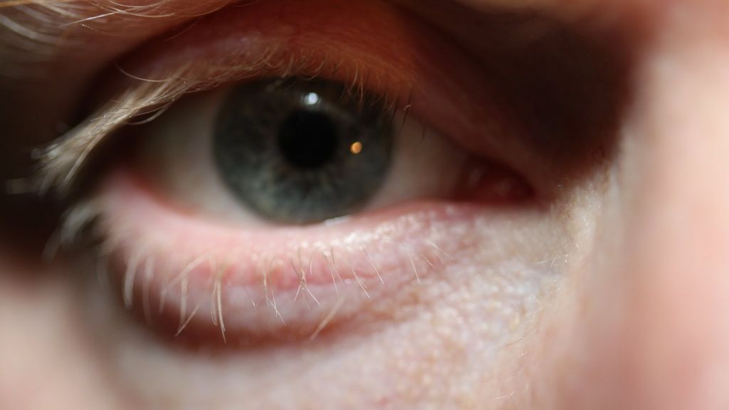 Test may spot glaucoma before symptoms begin, study says