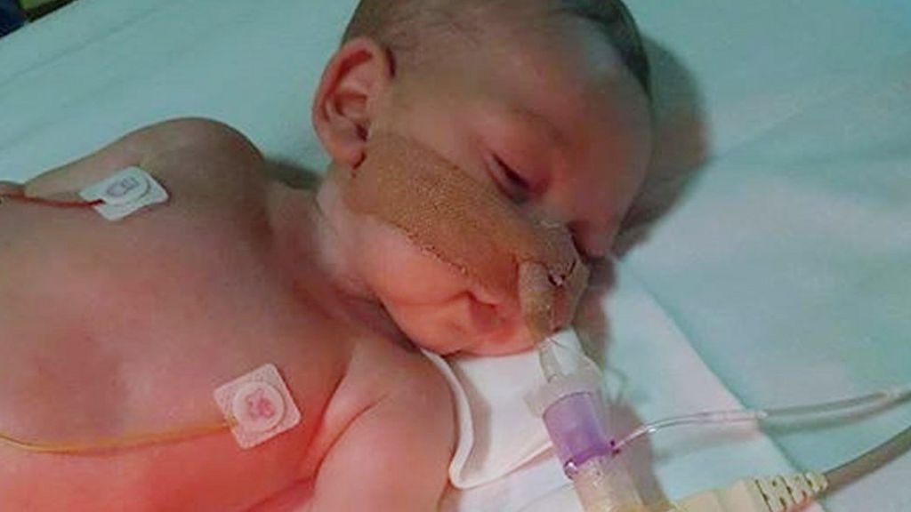Charlie Gard's parents fight for Supreme Court hearing