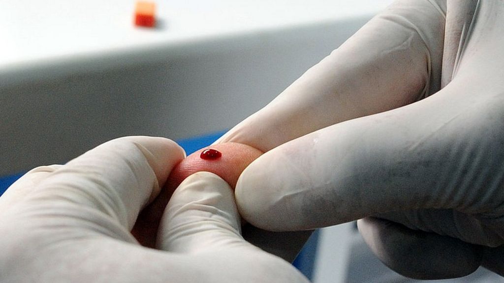 HIV doctor alert prompts recall of patients