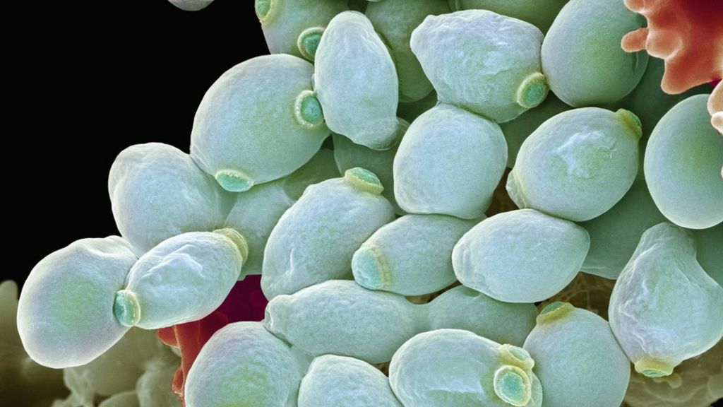 Fungal infection 'threat' to human health - BBC News