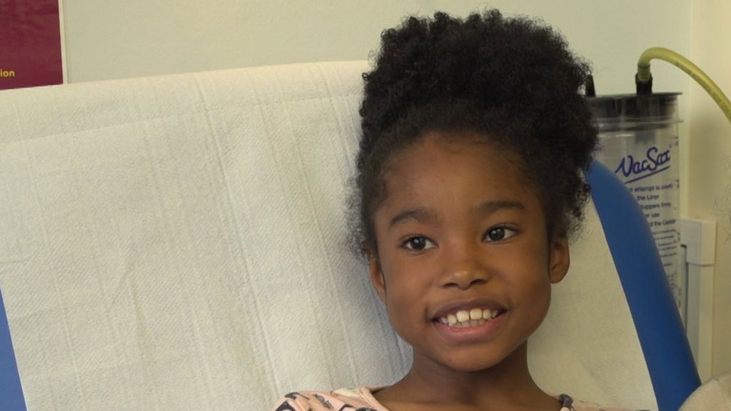 Girl suffered 32% burns when dress set alight 'like tissue paper'