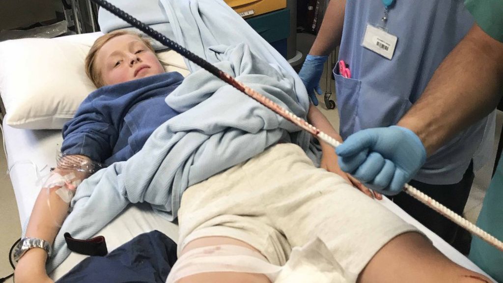 Irish Open: Boy impaled on metal rod at car park
