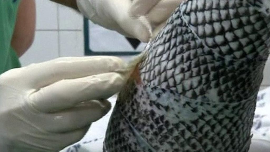 Can fish skin help treat burns?