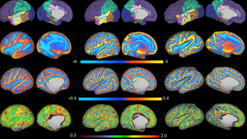 Baby brain scans reveal trillions of neural connections
