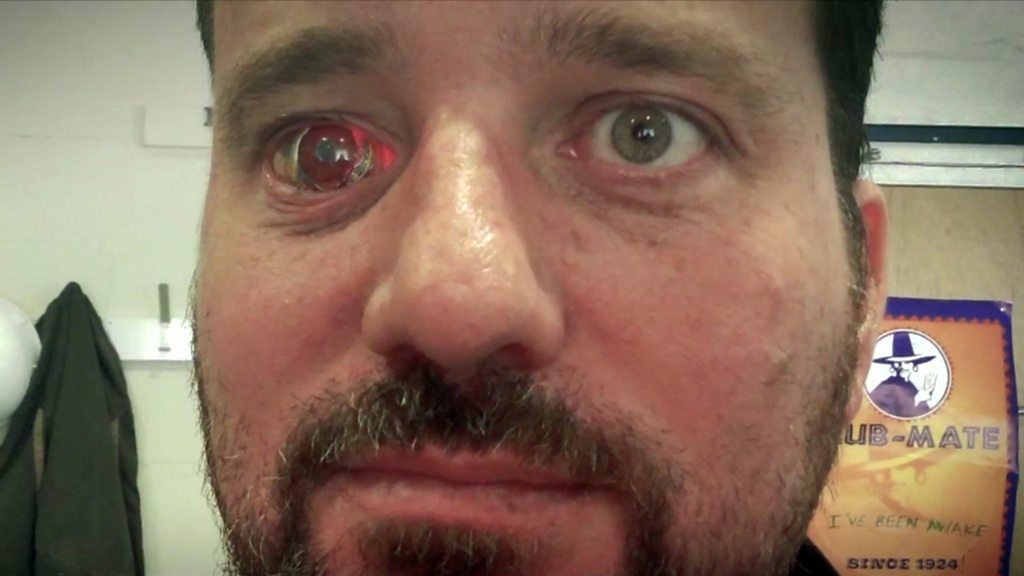 Meet Rob Spence, the film-maker with the camera eye