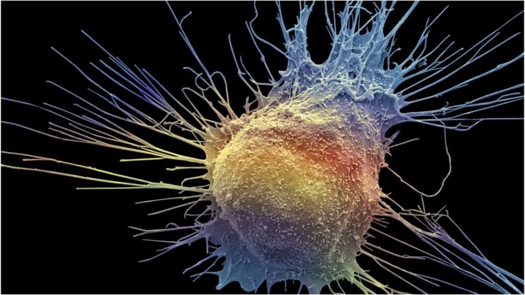 prostate-cancer-blood-test-could-help-target-treatment-bbc-news