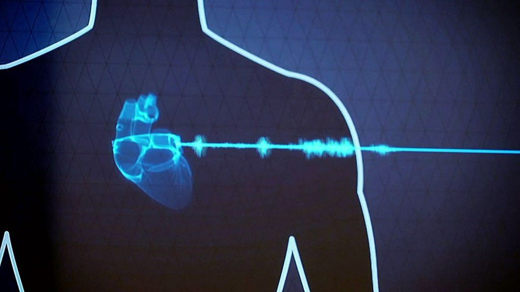New health scan uses artificial intelligence