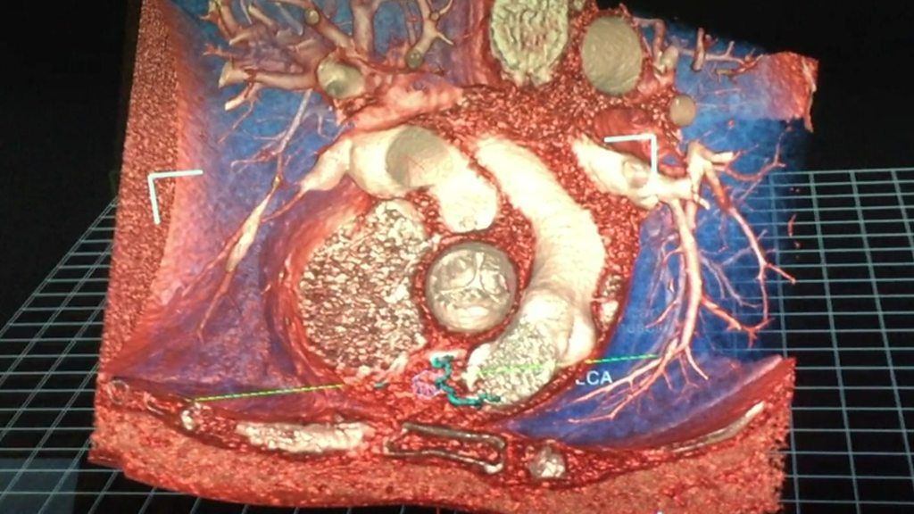The new 3D image tool for surgeons