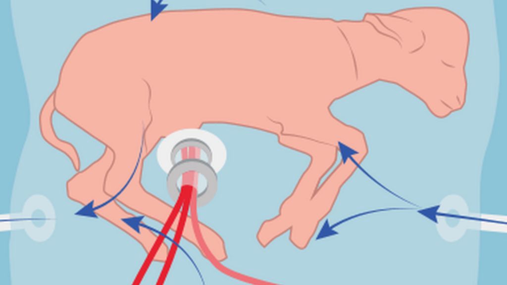 Premature lambs kept alive in 'plastic bag' womb