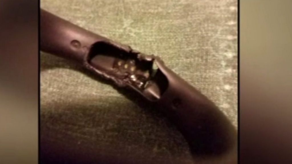 Fitbit investigates report of 'exploding' tracker