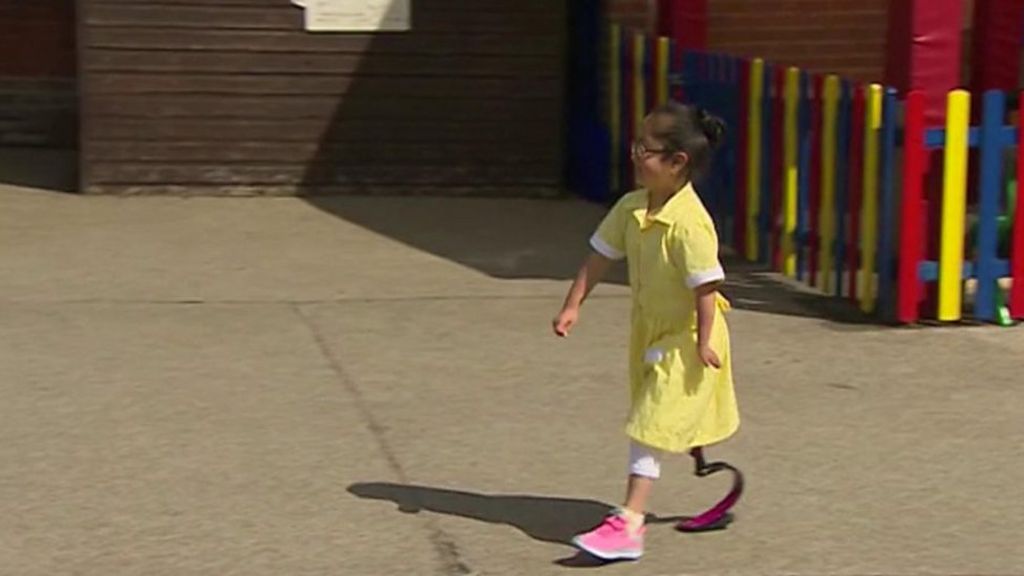 Seven-year-old returns to school with prosthetic aid