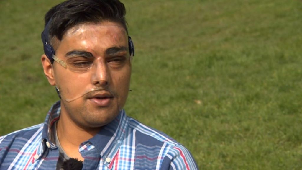 Acid attacks 'hidden' by fearful victims, say police