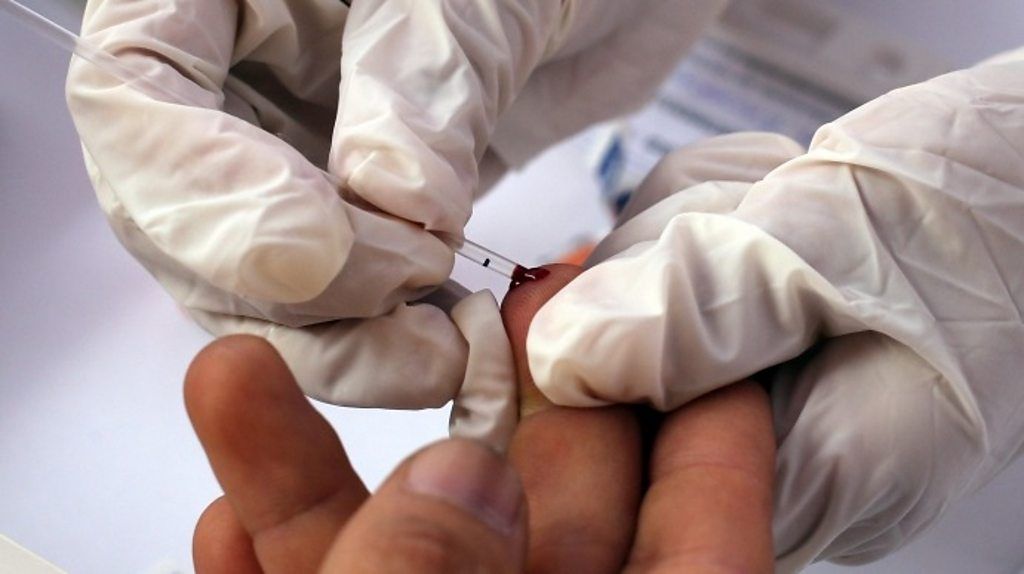 Pill could reduce HIV risk by 86 BBC News