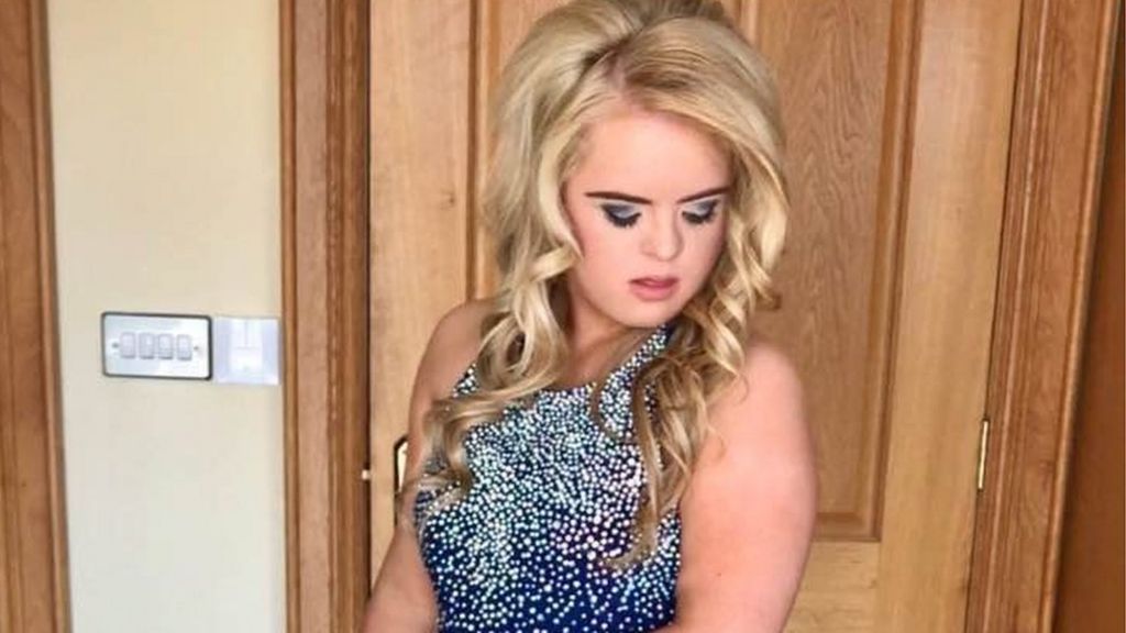 Catwalk Debut For Teenager With Downs Syndrome Bbc News 5165