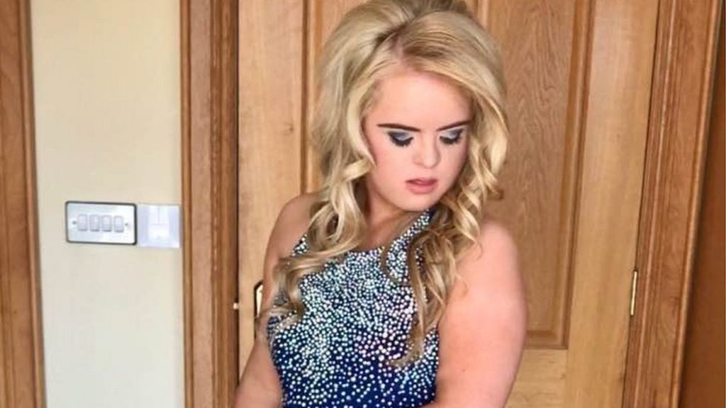 Catwalk Debut For Teenager With Downs Syndrome Bbc News 