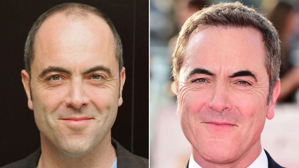 James Nesbitt Hair transplants helped me get better roles BBC News