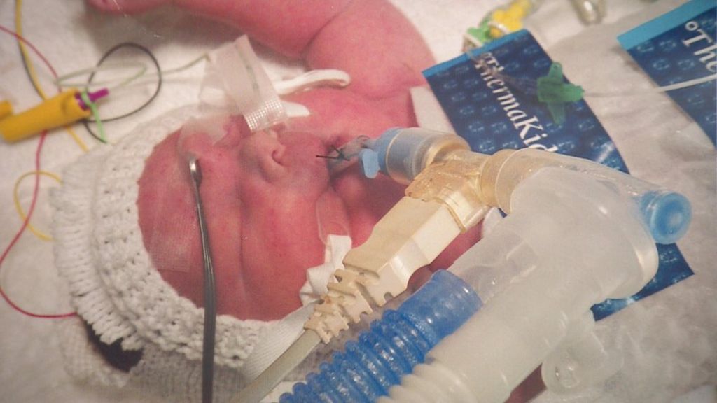 Parents' anger at baby deaths NHS trust