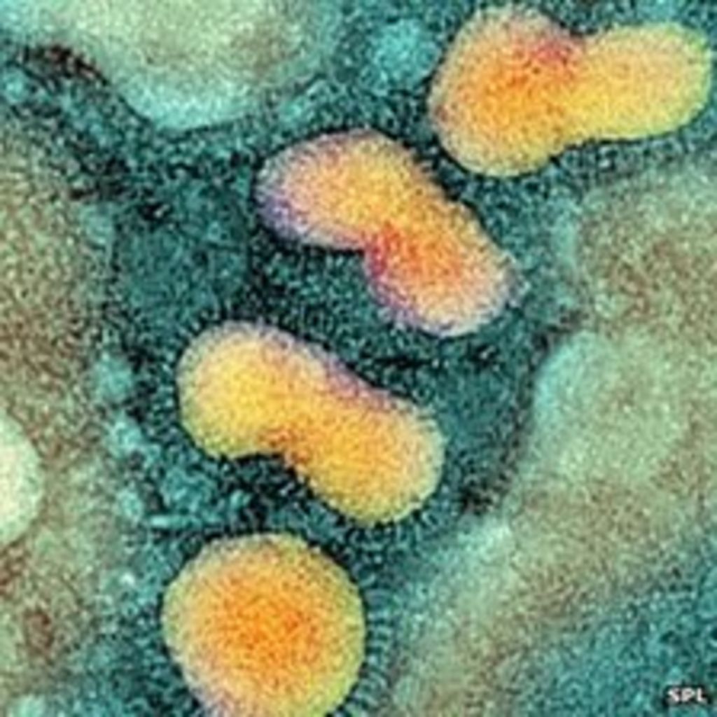 Bird Flu Could Mutate To Cause Deadly Human Pandemic BBC News    61052540 Birdflu2 