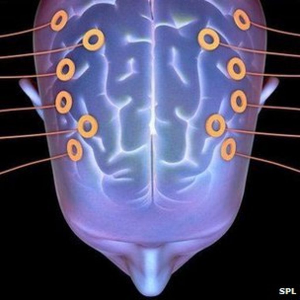 EEG brain trace 'can detect autism' BBC News
