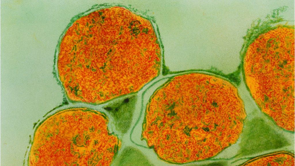 Leprosy bacteria use ‘biological alchemy’ - BBC News