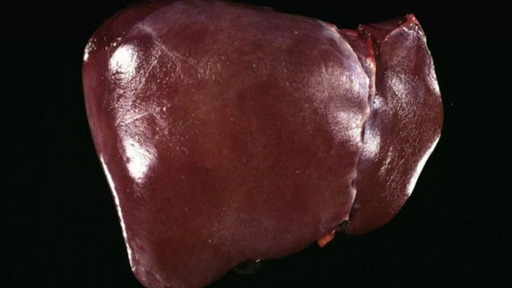 ‘Scandal’ of liver disease inaction BBC News