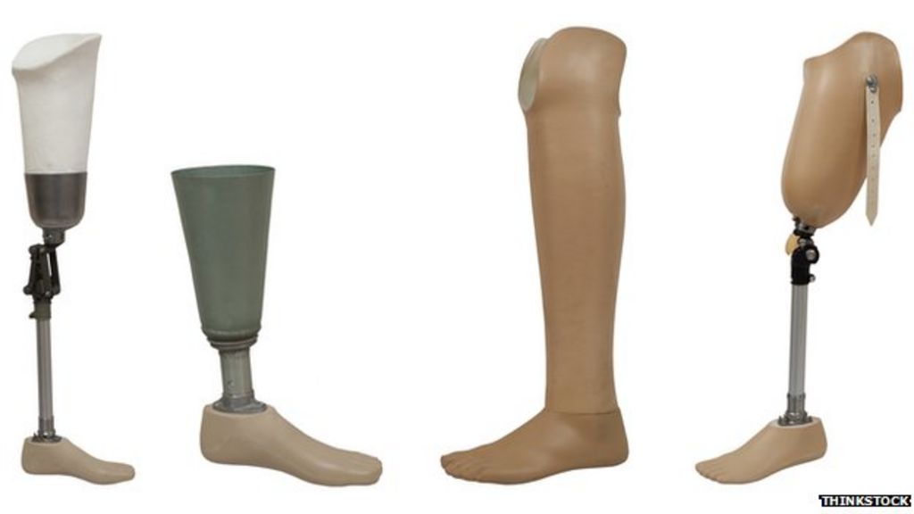 How Much Does An Artificial Leg Cost