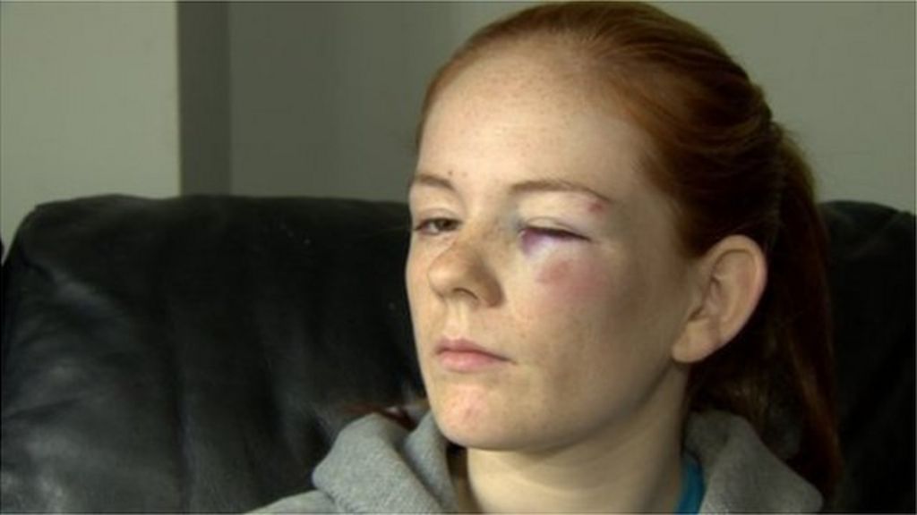 East Belfast Girl Attacked Near Sectarian Flashpoint Bbc News 5019